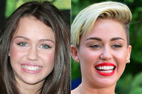 Celebrity Teeth and Smile Pictures.